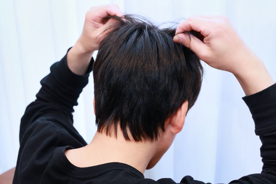 頭皮が赤い！？放置すると薄毛に繋がってしまうかも！