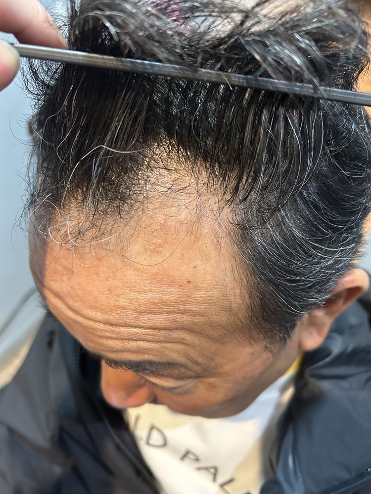 50代男性・約1ヶ月半後の分け目まわり
