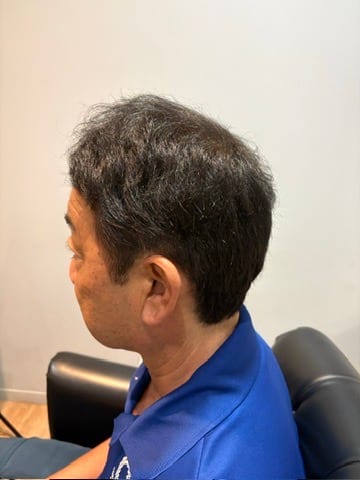 50代男性・約2年半後の側面