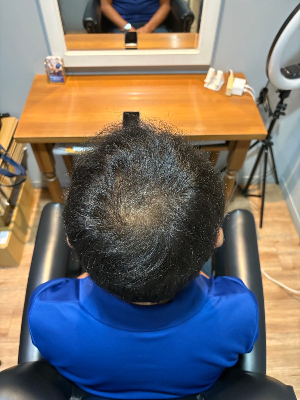 50代男性・約2年半後の頭頂部